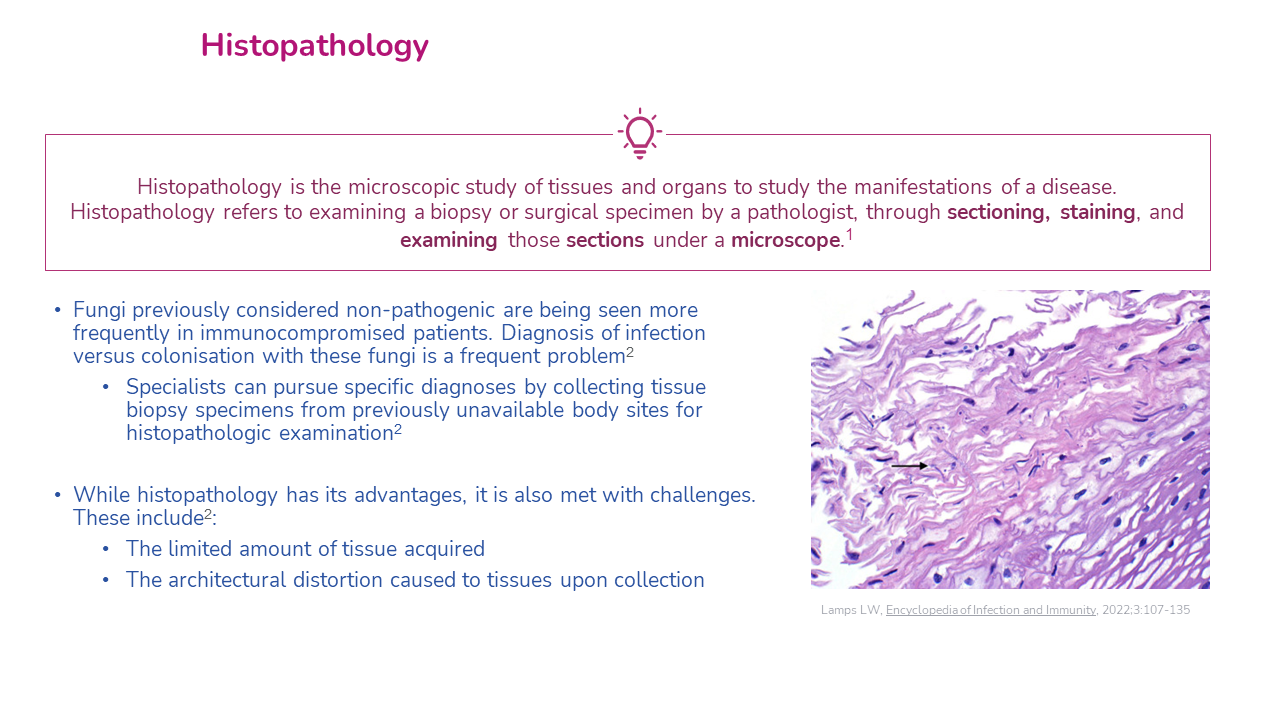 fungal diagnostic 10